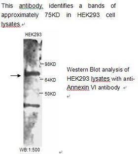ANXA6/Annexin A6/Annexin VI Antibody