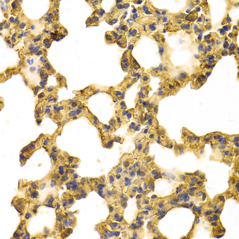 ANXA6/Annexin A6/Annexin VI Antibody - Immunohistochemistry of paraffin-embedded mouse lung tissue.