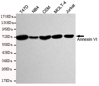 ANXA6/Annexin A6/Annexin VI Antibody - Western blot detection of Annexin VI in T47D, MB4, CEM, MOLT-4 and Jurkat cell lysates and using Annexin VI mouse monoclonal antibody (1:1000 dilution). Predicted band size: 76KDa. Observed band size:76KDa.