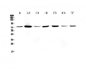 ANXA6/Annexin A6/Annexin VI Antibody - IHC analysis of Annexin VI using anti-Annexin VI antibody