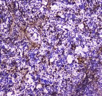 ANXA6/Annexin A6/Annexin VI Antibody - IHC analysis of Annexin VI using anti-Annexin VI antibody. Annexin VI was detected in paraffin-embedded section of rat spleen tissue. Heat mediated antigen retrieval was performed in citrate buffer (pH6, epitope retrieval solution) for 20 mins. The tissue section was blocked with 10% goat serum. The tissue section was then incubated with 2µg/ml rabbit anti-Annexin VI Antibody overnight at 4°C. Biotinylated goat anti-rabbit IgG was used as secondary antibody and incubated for 30 minutes at 37°C. The tissue section was developed using Strepavidin-Biotin-Complex (SABC) with DAB as the chromogen.