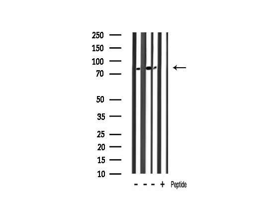 ANXA6/Annexin A6/Annexin VI Antibody - Western blot analysis of Annexin A6 expression in various lysates. The lane on the right is treated with the antigen-specific peptide.