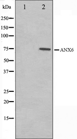 ANXA6/Annexin A6/Annexin VI Antibody - Western blot analysis on 293 cell lysates using Annexin A6 antibody. The lane on the left is treated with the antigen-specific peptide.