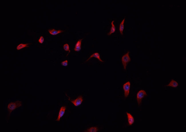 ANXA6/Annexin A6/Annexin VI Antibody - Staining HepG2 cells by IF/ICC. The samples were fixed with PFA and permeabilized in 0.1% Triton X-100, then blocked in 10% serum for 45 min at 25°C. The primary antibody was diluted at 1:200 and incubated with the sample for 1 hour at 37°C. An Alexa Fluor 594 conjugated goat anti-rabbit IgG (H+L) antibody, diluted at 1/600, was used as secondary antibody.