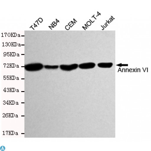 ANXA6/Annexin A6/Annexin VI Antibody - Western blot detection of Annexin VI in T47D, MB4, CEM, MOLT-4 and Jurkat cell lysates and using Annexin VI mouse mAb (1:1000 diluted). Predicted band size: 76KDa. Observed band size: 76KDa.