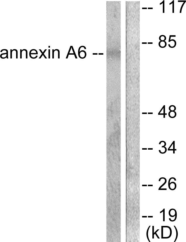 ANXA6/Annexin A6/Annexin VI Antibody - Western blot analysis of extracts from 293 cells, using Annexin A6 antibody.