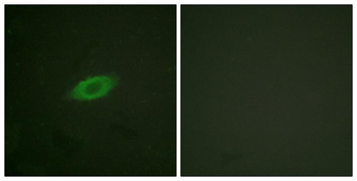 ANXA6/Annexin A6/Annexin VI Antibody - Forskolin + - Immunofluorescence analysis of HeLa cells, treated with Forskolin (40nM, 30mins), using Annexin A6 antibody.
