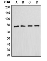ANXA6/Annexin A6/Annexin VI Antibody - Western blot analysis of Annexin A6 expression in HeLa (A); SP2/0 (B); rat kidney (C); HepG2 (D) whole cell lysates.