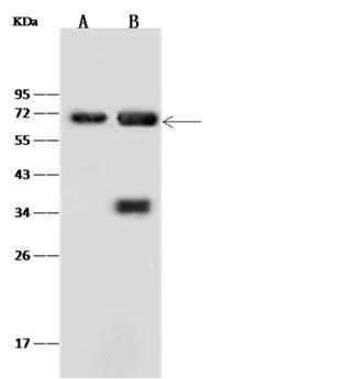 ANXA6/Annexin A6/Annexin VI Antibody - Anti-ANXA6 rabbit polyclonal antibody at 1:500 dilution. Lane A: NIH-3T3 Whole Cell Lysate. Lane B: Mouse Spleen tissue lysate. Lysates/proteins at 30 ug per lane. Secondary: Goat Anti-Rabbit IgG (H+L)/HRP at 1/10000 dilution. Developed using the ECL technique. Performed under reducing conditions. Predicted band size: 76 kDa. Observed band size: 72 kDa.