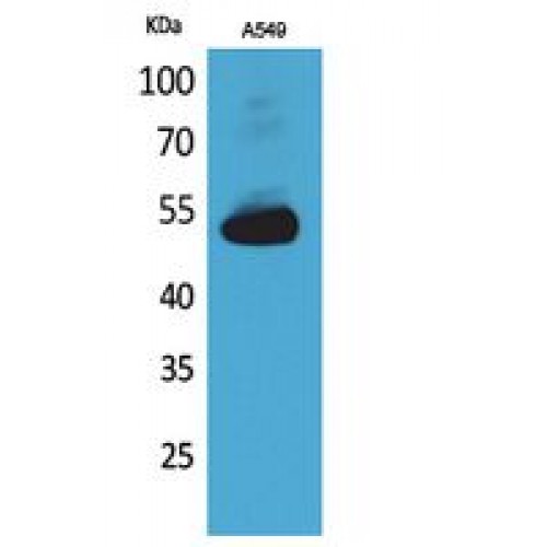 ANXA7 / Annexin VII / SNX Antibody - Western blot of Annexin VII antibody