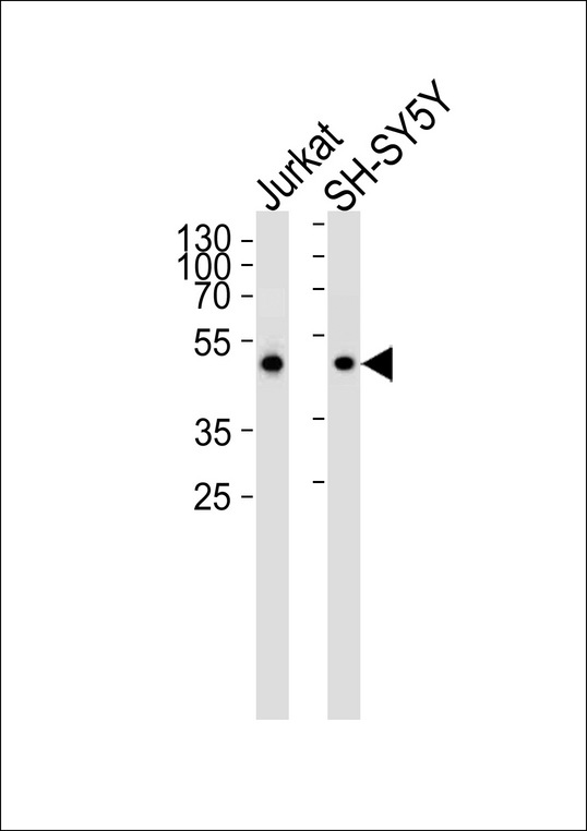 ANXA7 / Annexin VII / SNX Antibody - ANXA7 Antibody (Center) western blot analysis in Jurkat and SH-SY5Y cell lysates (35ug/lane). This demonstrates that the ANXA7 antibody detected ANXA7 protein (arrow).