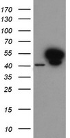 ANXA7 / Annexin VII / SNX Antibody - HEK293T cells were transfected with the pCMV6-ENTRY control (Left lane) or pCMV6-ENTRY ANXA7 (Right lane) cDNA for 48 hrs and lysed. Equivalent amounts of cell lysates (5 ug per lane) were separated by SDS-PAGE and immunoblotted with anti-ANXA7.