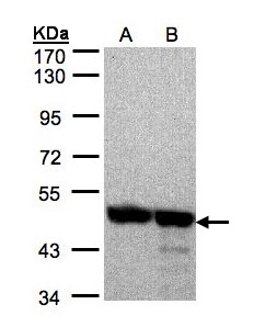 ANXA7 / Annexin VII / SNX Antibody - Sample (30 ug of whole cell lysate). A:293T, B: A431. 7.5% SDS PAGE. Annexin VII / SNX antibody diluted at 1:2000