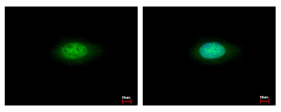 ANXA7 / Annexin VII / SNX Antibody - Annexin VII antibody detects ANXA7 protein at cytoplasm and nucleus by immunofluorescent analysis. HeLa cells were fixed in ice-cold MeOH for 5 min. ANXA7 protein stained by Annexin VII antibody diluted at 1:500. 