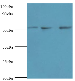 ANXA7 / Annexin VII / SNX Antibody - Western blot. All lanes: Annexin A7 antibody at 4 ug/ml. Lane 1: mouse heart tissue. Lane 2: Jurkat whole cell lysate. Lane 3: LO2 whole cell lysate. secondary Goat polyclonal to rabbit at 1:10000 dilution. Predicted band size: 53 kDa. Observed band size: 53 kDa.