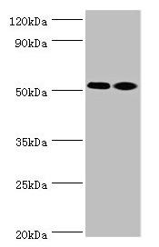 ANXA7 / Annexin VII / SNX Antibody - Western blot All lanes: ANXA7 antibody at 4µg/ml Lane 1: Jurkat whole cell lysate Lane 2: LO2 whole cell lysate Secondary Goat polyclonal to rabbit IgG at 1/10000 dilution Predicted band size: 53, 51 kDa Observed band size: 53 kDa