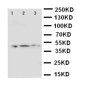 ANXA7 / Annexin VII / SNX Antibody - WB of ANXA7 / Annexin VII / SNX antibody. Lane 1: Rat Skeletal Muscle Tissue Lysate. Lane 2: SMMC Cell Lysate. Lane 3: COLO320 Cell Lysate.