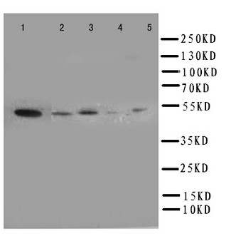 ANXA7 / Annexin VII / SNX Antibody - WB of ANXA7 / Annexin VII / SNX antibody. Lane 1: Rat Skeletal Muscle Tissue Lysate. Lane 2: HELA Cell Lysate. Lane 3: A549 Cell Lysate. Lane 4: SMMC Cell Lysate. Lane 5: HT1080 Cell Lysate..