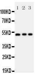 ANXA7 / Annexin VII / SNX Antibody - Anti-Annexin VII antibody, Western blotting All lanes: Anti Annexin VII at 0.5ug/ml Lane 1: Rat Skeletal Muscle Tissue Lysate at 50ug Lane 2: SMMC Whole Cell Lysate at 40ug Lane 3: COLO320 Whole Cell Lysate at 40ug Predicted bind size: 52KD Observed bind size: 52KD