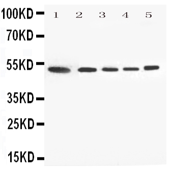 ANXA7 / Annexin VII / SNX Antibody - Anti-Annexin VII antibody, Western blotting All lanes: Anti Annexin VII at 0.5ug/ml Lane 1: Rat Skeletal Muscle Tissue Lysate at 50ug Lane 2: HELA Whole Cell Lysate at 40ug Lane 3: A549 Whole Cell Lysate at 40ug Lane 4: SMMC Whole Cell Lysate at 40ug Lane 5: HT1080 Whole Cell Lysate at 40ug Predicted bind size: 52KD Observed bind size: 52KD