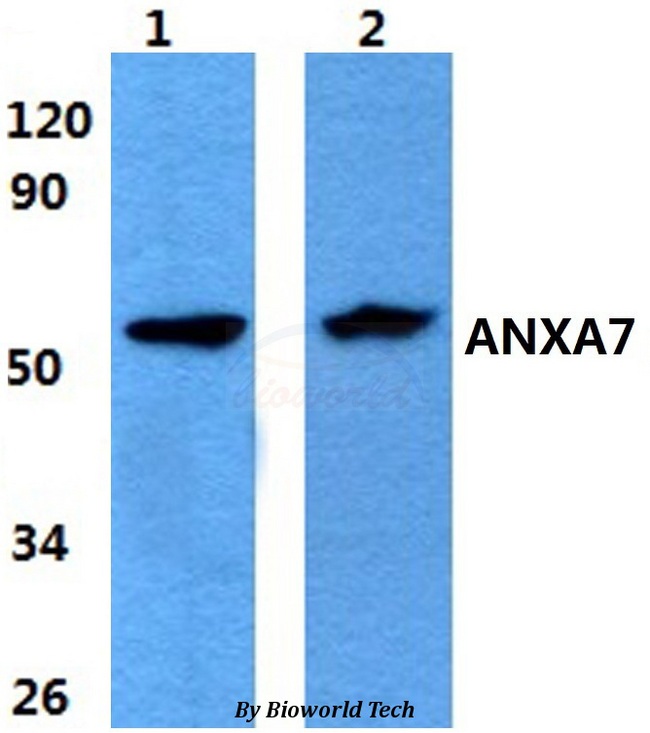 ANXA7 / Annexin VII / SNX Antibody - Western blot of ANXA7 antibody at 1:500 dilution. Lane 1: A549 whole cell lysate. Lane 2: sp2/0 whole cell lysate.