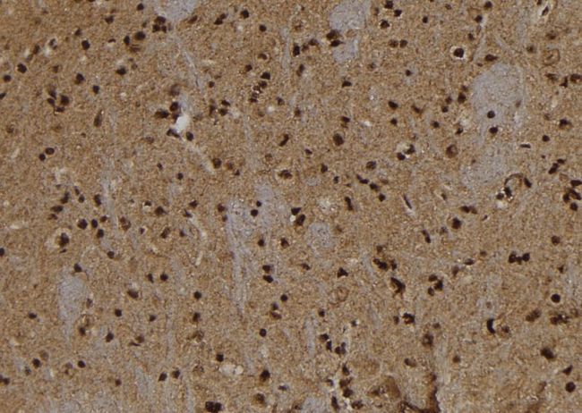 ANXA7 / Annexin VII / SNX Antibody - 1:100 staining rat brain tissue by IHC-P. The sample was formaldehyde fixed and a heat mediated antigen retrieval step in citrate buffer was performed. The sample was then blocked and incubated with the antibody for 1.5 hours at 22°C. An HRP conjugated goat anti-rabbit antibody was used as the secondary.