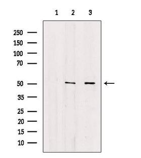 ANXA7 / Annexin VII / SNX Antibody - Western blot analysis of extracts of various samples using Annexin VII antibody. Lane 1: mouse brain treated with blocking peptide. Lane 2: mouse brain; Lane 3: HepG2;