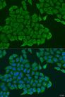 ANXA7 / Annexin VII / SNX Antibody - Immunofluorescence analysis of U2OS cells using ANXA7 Polyclonal Antibody at dilution of 1:100.Blue: DAPI for nuclear staining.