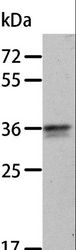 ANXA8 / Annexin A8 Antibody - Western blot analysis of A549 cell, using ANXA8 Polyclonal Antibody at dilution of 1:300.