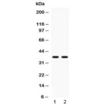 ANXA8 / Annexin A8 Antibody - Western blot testing of human 1) HeLa and 2) A549 cell lysate with Annexin VIII antibody at 0.5ug/ml. Predicted molecular weight ~37 kDa.