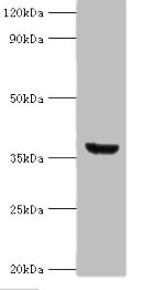 ANXA8L1 Antibody - Western blot All lanes: ANXA8L2 antibody at 18µg/ml + HepG2 whole cell lysate Secondary Goat polyclonal to rabbit IgG at 1/10000 dilution Predicted band size: 37, 31 kDa Observed band size: 37 kDa