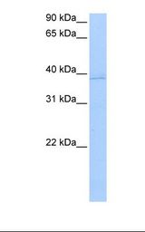 ANXA8L1 Antibody - MCF7 cell lysate. Antibody concentration: 0.5 ug/ml. Gel concentration: 12%.  This image was taken for the unconjugated form of this product. Other forms have not been tested.