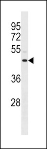 ANXA8L1 Antibody - ANXA8L1/ANXA8L2 Antibody western blot of MDA-MB231 cell line lysates (35 ug/lane). The ANXA8L1/ANXA8L2 antibody detected the ANXA8L1/ANXA8L2 protein (arrow).