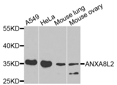 ANXA8L1 Antibody - Western blot analysis of extracts of various cells.