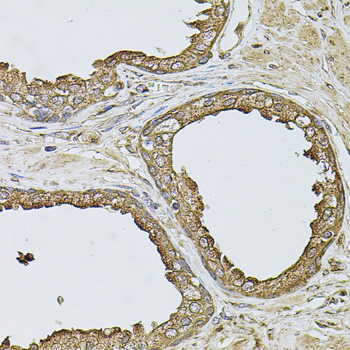 ANXA8L1 Antibody - Immunohistochemistry of paraffin-embedded human prostate tissue.