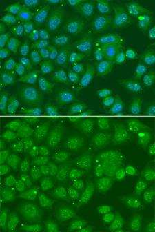 ANXA8L1 Antibody - Immunofluorescence analysis of A549 cells.