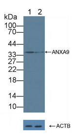 ANXA9 Antibody - Knockout Varification: Lane 1: Wild-type 293T cell lysate; Lane 2: ANXA9 knockout 293T cell lysate; Predicted MW: 38kd Observed MW: 35kd Primary Ab: 2µg/ml Rabbit Anti-Human ANXA9 Antibody Second Ab: 0.2µg/mL HRP-Linked Caprine Anti-Rabbit IgG Polyclonal Antibody