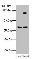 ANXA9 Antibody - Western blot All lanes: ANXA9 antibody at 8µg/ml Lane 1: Mouse kidney tissue Lane 2: A431 whole cell lysate Secondary Goat polyclonal to rabbit IgG at 1/10000 dilution Predicted band size: 38 kDa Observed band size: 38, 75 kDa
