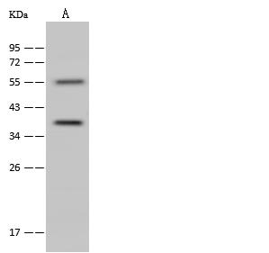 ANXA9 Antibody - Anti-ANXA9 rabbit polyclonal antibody at 1:500 dilution. Lane A: A431 Whole Cell Lysate. Lysates/proteins at 30 ug per lane. Secondary: Goat Anti-Rabbit IgG (H+L)/HRP at 1/10000 dilution. Developed using the ECL technique. Performed under reducing conditions. Predicted band size: 36 kDa. Observed band size: 36 kDa.