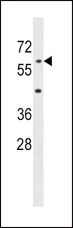 AOAH / Acyloxyacyl Hydrolase Antibody - AOAH Antibody western blot of mouse liver tissue lysates (35 ug/lane). The AOAH antibody detected the AOAH protein (arrow).