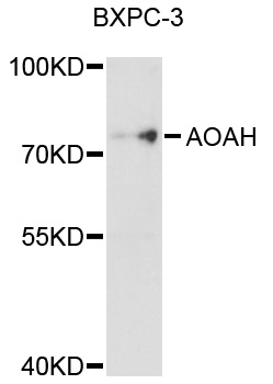 AOAH / Acyloxyacyl Hydrolase Antibody - Western blot analysis of extracts of BxPC-3 cells, using AOAH antibody at 1:1000 dilution. The secondary antibody used was an HRP Goat Anti-Rabbit IgG (H+L) at 1:10000 dilution. Lysates were loaded 25ug per lane and 3% nonfat dry milk in TBST was used for blocking. An ECL Kit was used for detection and the exposure time was 30s.