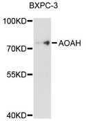 AOAH / Acyloxyacyl Hydrolase Antibody - Western blot analysis of extracts of BxPC-3 cells, using AOAH antibody at 1:1000 dilution. The secondary antibody used was an HRP Goat Anti-Rabbit IgG (H+L) at 1:10000 dilution. Lysates were loaded 25ug per lane and 3% nonfat dry milk in TBST was used for blocking. An ECL Kit was used for detection and the exposure time was 30s.