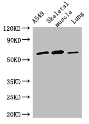 AOAH / Acyloxyacyl Hydrolase Antibody - Positive WB detected in:A549 whole cell lysate,Mouse skeletal muscle tissue,Rat lung tissue;All lanes:AOAH antibody at 2.5?g/ml;Secondary;Goat polyclonal to rabbit IgG at 1/50000 dilution;Predicted band size: 66,62 KDa;Observed band size: 66 KDa;