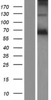 AOAH / Acyloxyacyl Hydrolase Protein - Western validation with an anti-DDK antibody * L: Control HEK293 lysate R: Over-expression lysate