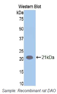 AOC1 Antibody - Western blot of recombinant AOC1 / ABP1 / DAO.  This image was taken for the unconjugated form of this product. Other forms have not been tested.