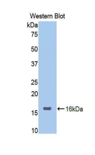 AOC1 Antibody - Western blot of recombinant AOC1 / ABP1 / DAO.  This image was taken for the unconjugated form of this product. Other forms have not been tested.