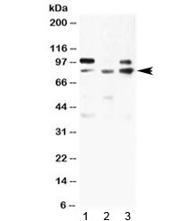 AOC1 Antibody - Western blot testing of 1) rat skeletal NRK, 2) human 293T and 3) human MCF7 lysate with ABP1 antibody at 0.5ug/ml. Predicted molecular weight ~85 kDa.