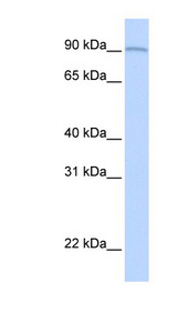 AOC2 / SSAO Antibody - AOC2 antibody Western blot of Fetal Lung lysate. This image was taken for the unconjugated form of this product. Other forms have not been tested.