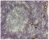 AOC3 / VAP-1 Antibody - IHC of VAP-1 on human tonsil tissue. Staining of frozen tissue section with AOC3 / VAP-1 antibody. Anti-human VAP-1 staining results in vessels that are VAP-1 positive, whereas morphologically similar vessels next to positive ones can be negative.