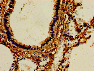 AOC3 / VAP-1 Antibody - Immunohistochemistry image of paraffin-embedded human lung tissue at a dilution of 1:100